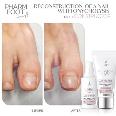 Pharm foot - reCONSTRUCTOR PODO nail set - Victoria Vynn - Alla produkter -glamandbeauty.se Pharm foot - reCONSTRUCTOR PODO nail set - Victoria Vynn - Alla produkter -glamandbeauty.se