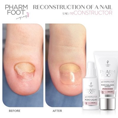 Pharm foot - reCONSTRUCTOR PODO nail set - Victoria Vynn - Alla produkter -glamandbeauty.se Pharm foot - reCONSTRUCTOR PODO nail set - Victoria Vynn - Alla produkter -glamandbeauty.se